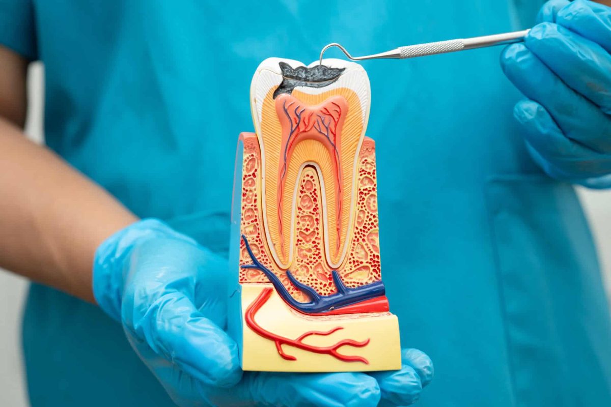 Asian dentist holding dental implant, artificial tooth roots into jaw, root canal of dental treatment, gum disease, teeth model for dentist.