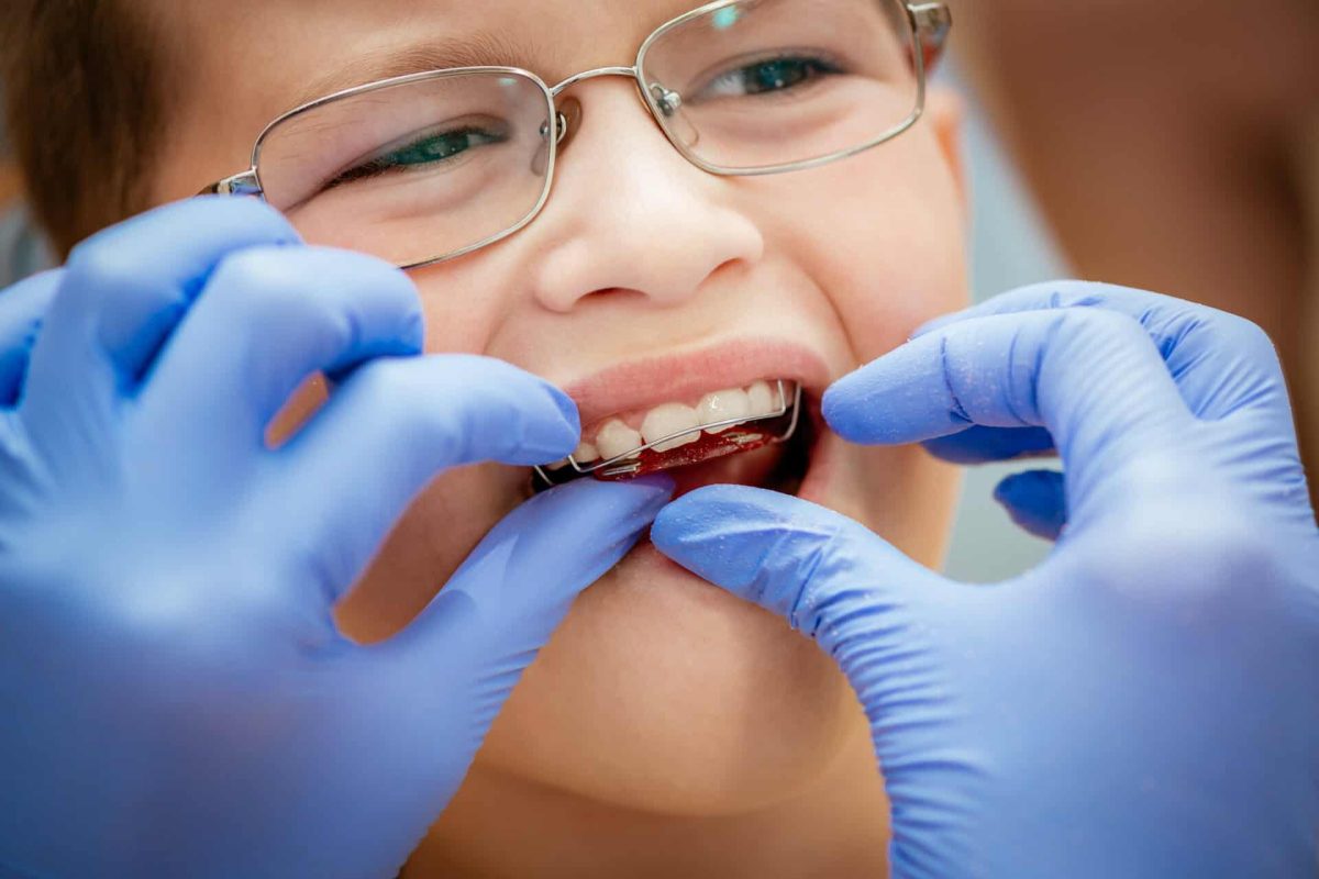 Dentist checking mobile orthodontic appliance for dental correction to the child patient. Close-up. Real People.
