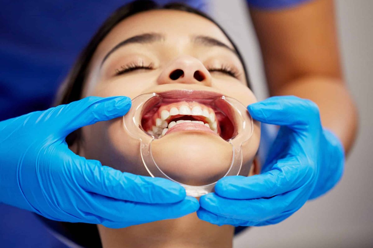 Using a cheek retractor can make a real difference.